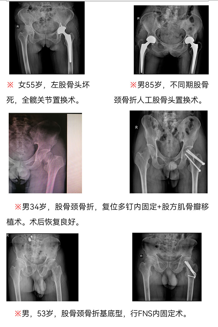 樅陽(yáng)縣中醫(yī)院骨傷科簡(jiǎn)介