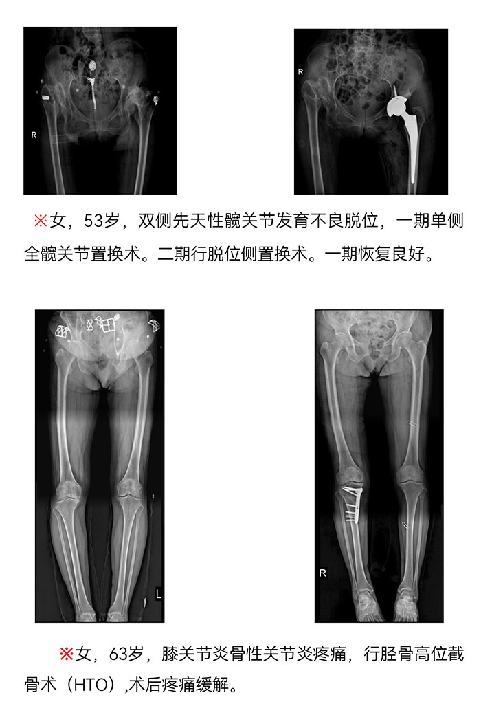 樅陽(yáng)縣中醫(yī)院骨傷科簡(jiǎn)介