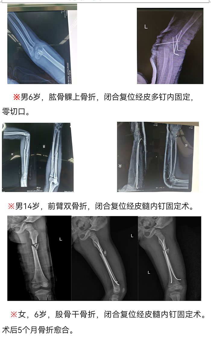樅陽(yáng)縣中醫(yī)院骨傷科簡(jiǎn)介