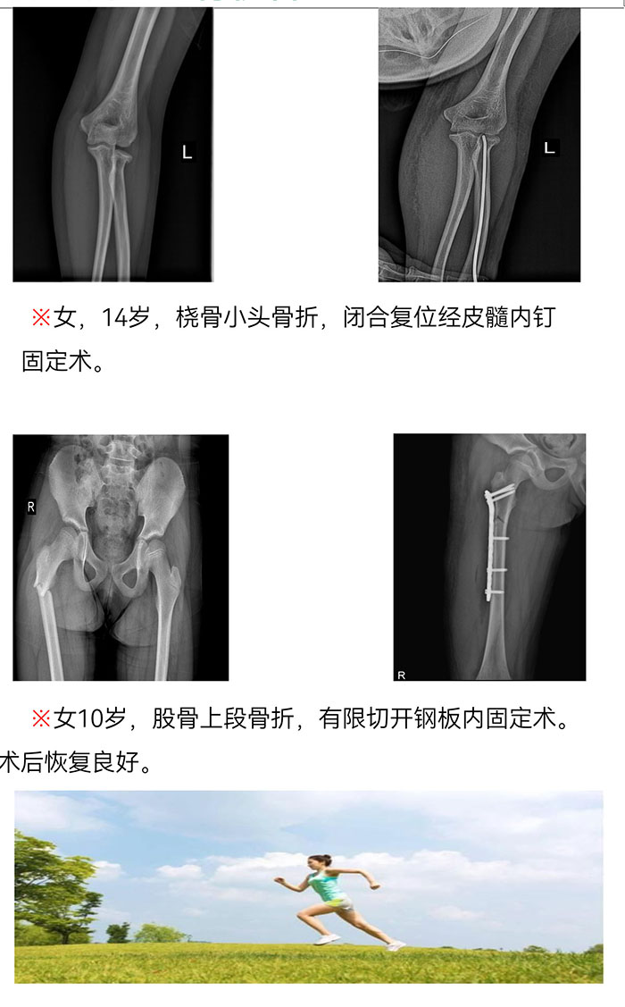 樅陽(yáng)縣中醫(yī)院骨傷科簡(jiǎn)介